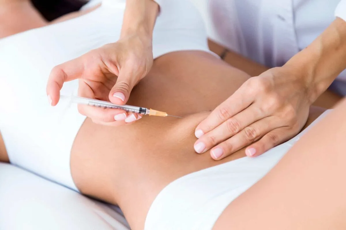 Mesoterapia
